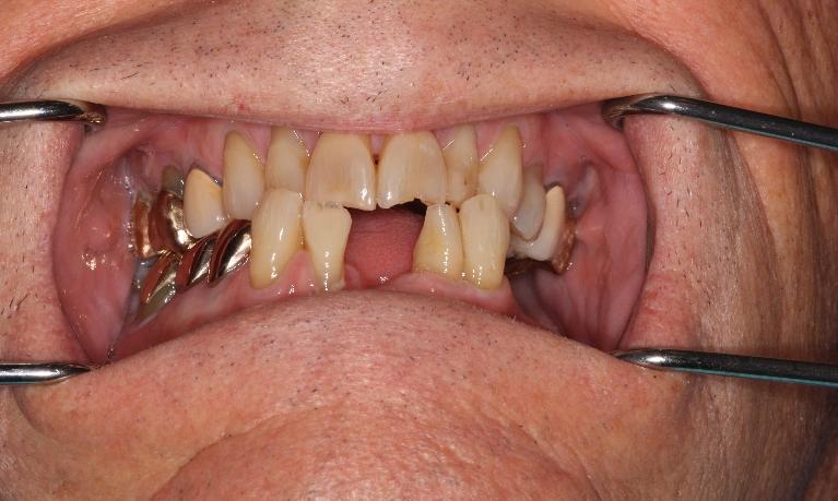 Dramatic-Difference-Before-Image